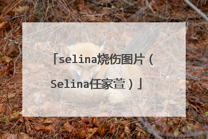 selina烧伤图片（Selina任家萱）