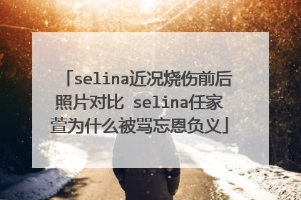 selina近况烧伤前后照片对比 selina任家萱为什么被骂忘恩负义